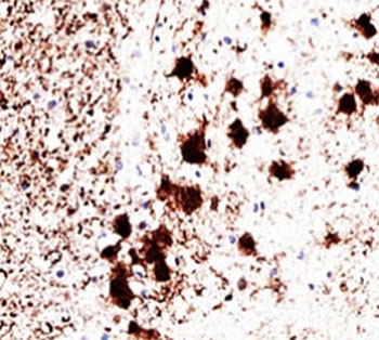 UCHL1 / PGP9.5 Antibody - PGP9.5 antibody 31A3 immunohistochemistry brain.  This image was taken for the unmodified form of this product. Other forms have not been tested.