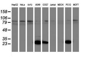 UCHL1 / PGP9.5 Antibody - Western blot of extracts (35ug) from 9 different cell lines by using anti-UCHL1 monoclonal antibody (HepG2: human; HeLa: human; SVT2: mouse; A549: human; COS7: monkey; Jurkat: human; MDCK: canine; PC12: rat; MCF7: human).