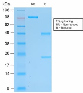 UCHL1 / PGP9.5 Antibody - SDS-PAGE Analysis Purified Pgp9.5 Mouse Recombinant Monoclonal Antibody (rUCHL1/775). Confirmation of Purity and Integrity of Antibody.