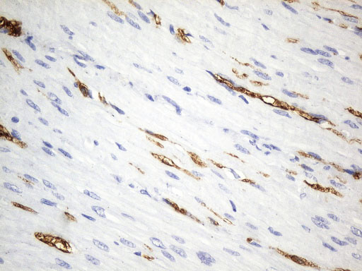 UCHL1 / PGP9.5 Antibody - Immunohistochemical staining of paraffin-embedded Human colon tissue within the normal limits using anti-UCHL1. (PGP9.5) mouse monoclonal antibody. (Heat-induced epitope retrieval by 1mM EDTA in 10mM Tris buffer. (pH8.5) at 120°C for 3 min. (1:600)