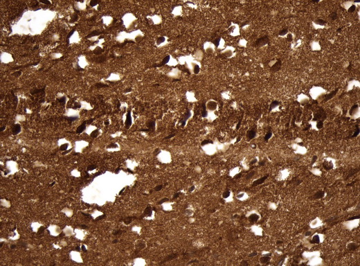 UCHL1 / PGP9.5 Antibody - Immunohistochemical staining of paraffin-embedded Human adult brain tissue within the normal limits using anti-UCHL1. (PGP9.5) mouse monoclonal antibody. (Heat-induced epitope retrieval by 1mM EDTA in 10mM Tris buffer. (pH8.5) at 120 oC for 3 min. (1:600)