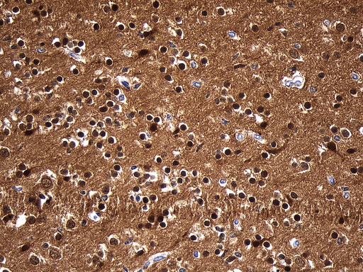 UCHL1 / PGP9.5 Antibody - Immunohistochemical staining of paraffin-embedded Human embryonic brain cortex tissue within the normal limits using anti-UCHL1. (PGP9.5) mouse monoclonal antibody. (Heat-induced epitope retrieval by 1mM EDTA in 10mM Tris buffer. (pH8.5) at 120 oC for 3 min. (1:600)