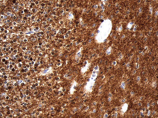 UCHL1 / PGP9.5 Antibody - Immunohistochemical staining of paraffin-embedded Human embryonic cerebellum within the normal limits using anti-UCHL1. (PGP9.5) Mouse monoclonal antibody. (Heat-induced epitope retrieval by 1mM EDTA in 10mM Tris buffer. (pH8.5) at 120 oC for 3 min. (1:600)