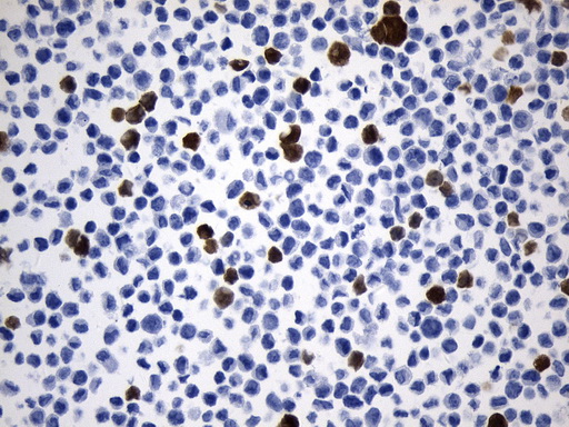 UCHL1 / PGP9.5 Antibody - Immunohistochemical staining of paraffin-embedded NIH/3T3 cell pellets using anti-UCHL1. (PGP9.5) mouse monoclonal antibody. (Heat-induced epitope retrieval by 1mM EDTA in 10mM Tris buffer. (pH8.0) at 120°C for 2.5 min. (1:600)