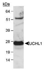 UCHL1 / PGP9.5 Antibody - Detection of UCHL1 in mouse brain lysate. ECL detection, 60 seconds.  This image was taken for the unconjugated form of this product. Other forms have not been tested.