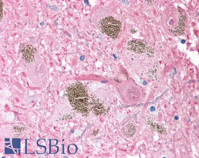 UCHL1 / PGP9.5 Antibody - Anti-UCHL1 / PGP9.5 antibody IHC of human brain, substantia nigra. Immunohistochemistry of formalin-fixed, paraffin-embedded tissue after heat-induced antigen retrieval. Antibody concentration 10 ug/ml.  This image was taken for the unconjugated form of this product. Other forms have not been tested.