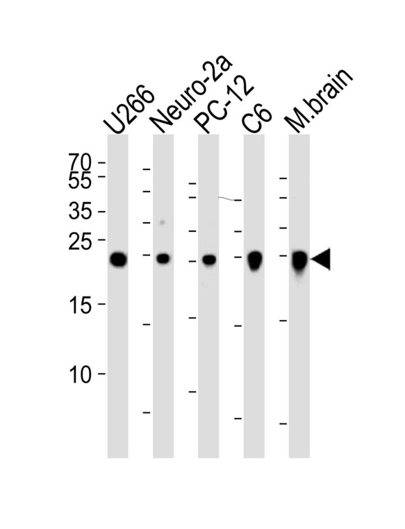 UCHL1 / PGP9.5 Antibody - Western blot of lysates from U266, mouse Neuro-2a, rat PC-12, C6 cell line and mouse brain tissue lysate(from left to right), using UCHL1 Antibody. Antibody was diluted at 1:1000 at each lane. A goat anti-mouse IgG H&L (HRP) at 1:3000 dilution was used as the secondary antibody. Lysates at 35ug per lane.