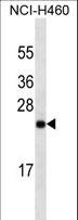 UCHL1 / PGP9.5 Antibody - UCHL1 Antibody western blot of NCI-H460 cell line lysates (35 ug/lane). The UCHL1 antibody detected the UCHL1 protein (arrow).