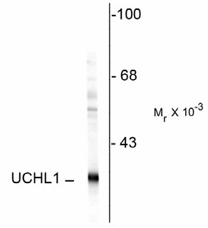 UCHL1 / PGP9.5 Antibody - Western Blot of UCHL1 antibody. Western blot of rat hippocampal homogenate showing specific immunolabeling of ~ 24k UCHL1 protein