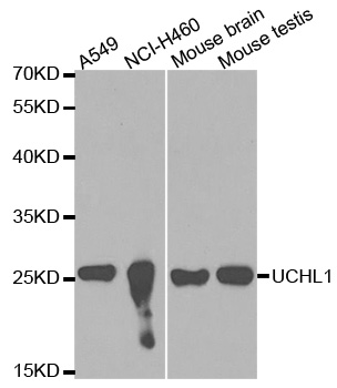 UCHL1 / PGP9.5 Antibody - Western blot analysis of extracts of various cell lines.