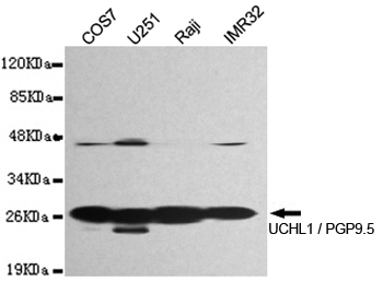 UCHL1 / PGP9.5 Antibody - Western blot detection of UCHL1 / PGP9.5 in U251, IMR32, Raji and COS7 cell lysates and using UCHL1 / PGP9.5 mouse monoclonal antibody (1:1000 dilution). Predicted band size: 25KDa. Observed band size: 28KDa.