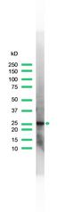 UCHL1 / PGP9.5 Antibody - Western blot of UCHL1 / PGP9.5 antibody