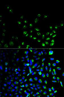 UCHL1 / PGP9.5 Antibody - Immunofluorescence analysis of HeLa cells using UCHL1 antibody. Blue: DAPI for nuclear staining.