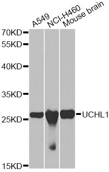 UCHL1 / PGP9.5 Antibody - Western blot analysis of extracts of various cell lines, using UCHL1 antibody at 1:1000 dilution. The secondary antibody used was an HRP Goat Anti-Rabbit IgG (H+L) at 1:10000 dilution. Lysates were loaded 25ug per lane and 3% nonfat dry milk in TBST was used for blocking.