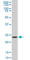 UCHL3 Antibody - UCHL3 monoclonal antibody (M01), clone 4E9. Western Blot analysis of UCHL3 expression in PC-12.