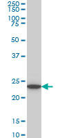 UCHL3 Antibody - UCHL3 monoclonal antibody (M01), clone 4E9 Western Blot analysis of UCHL3 expression in K-562.