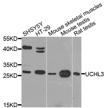UCHL3 Antibody - Western blot analysis of extract of various cells.