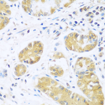 UCHL3 Antibody - Immunohistochemistry of paraffin-embedded human stomach tissue.