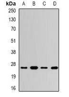 UCHL3 Antibody - Western blot analysis of UCH-L3 expression in SHSY5Y (A); HT29 (B); mouse testis (C); rat testis (D) whole cell lysates.
