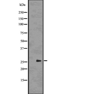 UCHL3 Antibody - Western blot analysis UCHL3 using HT29 whole cells lysates