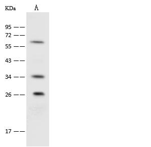 UCHL3 Antibody - Anti-UCHL3 rabbit polyclonal antibody at 1:500 dilution. Lane A: Jurkat Whole Cell Lysate. Lysates/proteins at 30 ug per lane. Secondary: Goat Anti-Rabbit IgG (H+L)/HRP at 1/10000 dilution. Developed using the ECL technique. Performed under reducing conditions. Predicted band size: 26 kDa. Observed band size: 26 kDa.