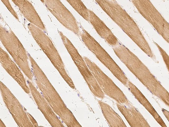 UCHL3 Antibody - Immunochemical staining of human UCHL3 in human skeletal muscle with rabbit polyclonal antibody at 1:300 dilution, formalin-fixed paraffin embedded sections.