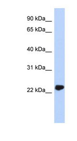 UCHL3 Antibody - UCHL3 antibody Western blot of MCF7 cell lysate. This image was taken for the unconjugated form of this product. Other forms have not been tested.