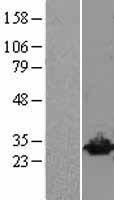 UCHL3 Protein - Western validation with an anti-DDK antibody * L: Control HEK293 lysate R: Over-expression lysate
