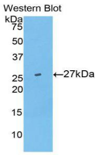 UCHL5 / UCH37 Antibody - Western blot of recombinant UCHL5 / UCH37.  This image was taken for the unconjugated form of this product. Other forms have not been tested.
