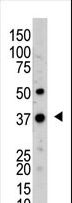 UCHL5 / UCH37 Antibody - The anti-UCHL5 antibody is used in Western blot to detect UCHL5 in mouse kidney tissue lysate.