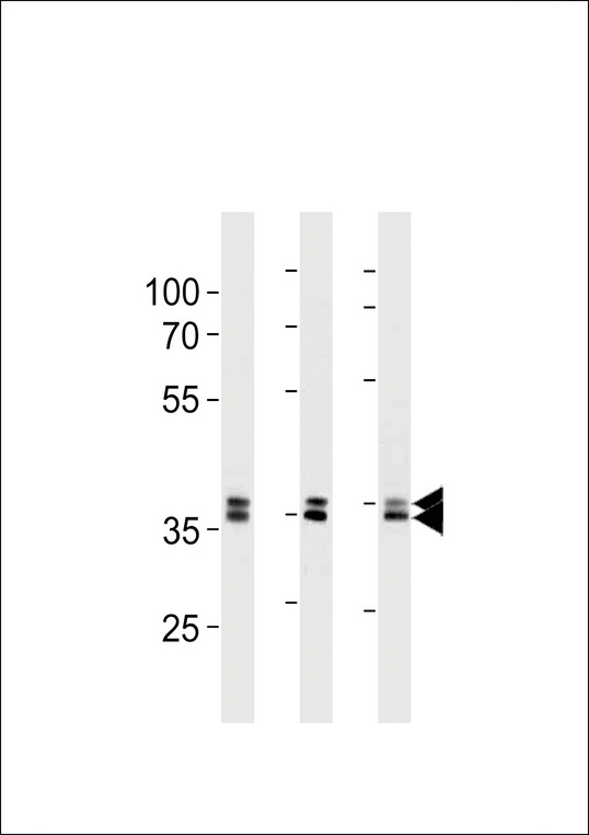 UCHL5 / UCH37 Antibody - UCH37 (UCHL5) Antibody western blot of 293,HeLa,293T cell line lysates (35 ug/lane). The UCHL5 antibody detected the UCHL5 protein (arrow).