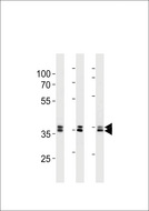 UCHL5 / UCH37 Antibody - UCH37 (UCHL5) Antibody western blot of 293,HeLa,293T cell line lysates (35 ug/lane). The UCHL5 antibody detected the UCHL5 protein (arrow).