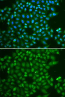 UCHL5 / UCH37 Antibody - Immunofluorescence analysis of A549 cells.