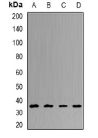 UCHL5 / UCH37 Antibody - Western blot analysis of UCH-L5 expression in HT29 (A); HeLa (B); mouse liver (C); rat brain (D) whole cell lysates.