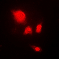 UCHL5 / UCH37 Antibody - Immunofluorescent analysis of UCH-L5 staining in A549 cells. Formalin-fixed cells were permeabilized with 0.1% Triton X-100 in TBS for 5-10 minutes and blocked with 3% BSA-PBS for 30 minutes at room temperature. Cells were probed with the primary antibody in 3% BSA-PBS and incubated overnight at 4 deg C in a humidified chamber. Cells were washed with PBST and incubated with a DyLight 594-conjugated secondary antibody (red) in PBS at room temperature in the dark.