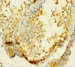 UCK1 Antibody - Immunohistochemistry of paraffin-embedded human testis tissue using UCK1 Antibody at dilution of 1:100