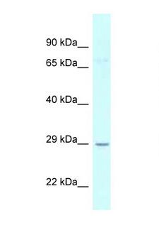 UCK1 Antibody - UCK1 antibody Western blot of HeLa Cell lysate. Antibody concentration 1 ug/ml.  This image was taken for the unconjugated form of this product. Other forms have not been tested.