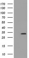 UCK1 Antibody - HEK293T cells were transfected with the pCMV6-ENTRY control (Left lane) or pCMV6-ENTRY UCK1 (Right lane) cDNA for 48 hrs and lysed. Equivalent amounts of cell lysates (5 ug per lane) were separated by SDS-PAGE and immunoblotted with anti-UCK1.