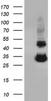 UCK1 Antibody - HEK293T cells were transfected with the pCMV6-ENTRY control (Left lane) or pCMV6-ENTRY UCK1 (Right lane) cDNA for 48 hrs and lysed. Equivalent amounts of cell lysates (5 ug per lane) were separated by SDS-PAGE and immunoblotted with anti-UCK1.
