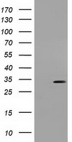 UCK1 Antibody - HEK293T cells were transfected with the pCMV6-ENTRY control (Left lane) or pCMV6-ENTRY UCK1 (Right lane) cDNA for 48 hrs and lysed. Equivalent amounts of cell lysates (5 ug per lane) were separated by SDS-PAGE and immunoblotted with anti-UCK1.