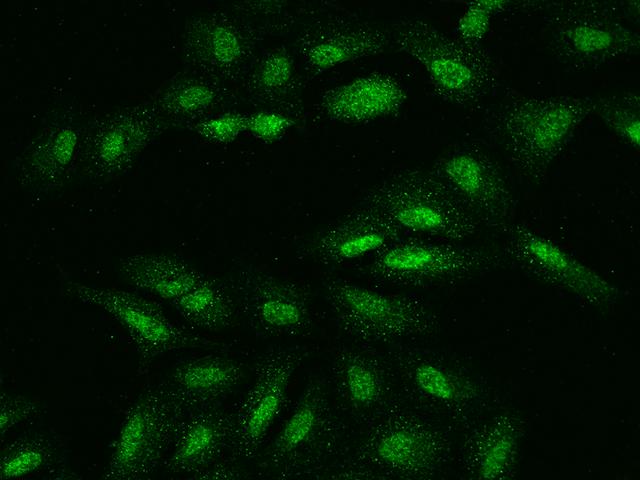 UCK1 Antibody - Immunofluorescence staining of UCK1 in U2OS cells. Cells were fixed with 4% PFA, permeabilzed with 0.1% Triton X-100 in PBS, blocked with 10% serum, and incubated with rabbit anti-Human UCK1 polyclonal antibody (dilution ratio 1:200) at 4°C overnight. Then cells were stained with the Alexa Fluor 488-conjugated Goat Anti-rabbit IgG secondary antibody (green). Positive staining was localized to Nucleus.
