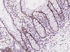 UCK1 Antibody - Immunochemical staining of human UCK1 in human large intestine with rabbit polyclonal antibody at 1:500 dilution, formalin-fixed paraffin embedded sections.