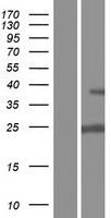 UCK1 Protein - Western validation with an anti-DDK antibody * L: Control HEK293 lysate R: Over-expression lysate