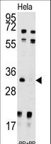 UCK2 Antibody - Western blot of anti-UCK2 Antibody pre-incubated with and without blocking peptide (BP7192a) in HeLa cell line lysate. UCK2(arrow) was detected using the purified antibody.