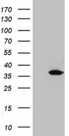 UCK2 Antibody - HEK293T cells were transfected with the pCMV6-ENTRY control. (Left lane) or pCMV6-ENTRY UCK2. (Right lane) cDNA for 48 hrs and lysed. Equivalent amounts of cell lysates. (5 ug per lane) were separated by SDS-PAGE and immunoblotted with anti-UCK2. (1:500)