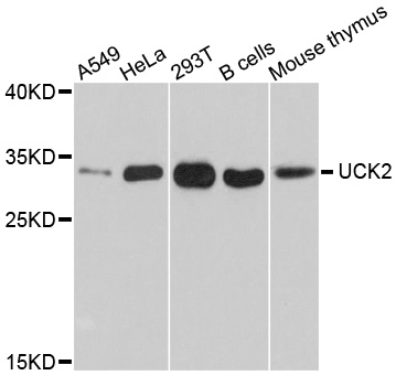 UCK2 Antibody - Western blot analysis of extracts of various cell lines, using UCK2 antibody at 1:1000 dilution. The secondary antibody used was an HRP Goat Anti-Rabbit IgG (H+L) at 1:10000 dilution. Lysates were loaded 25ug per lane and 3% nonfat dry milk in TBST was used for blocking. An ECL Kit was used for detection and the exposure time was 90s.