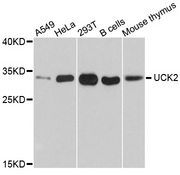 UCK2 Antibody - Western blot analysis of extracts of various cell lines, using UCK2 antibody at 1:1000 dilution. The secondary antibody used was an HRP Goat Anti-Rabbit IgG (H+L) at 1:10000 dilution. Lysates were loaded 25ug per lane and 3% nonfat dry milk in TBST was used for blocking. An ECL Kit was used for detection and the exposure time was 90s.