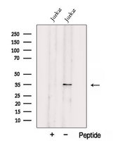 UCK2 Antibody - Western blot analysis of extracts of Jurkat cells using UCK2 antibody. The lane on the left was treated with blocking peptide.
