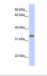 UCK2 Antibody - Jurkat cell lysate. Antibody concentration: 1.0 ug/ml. Gel concentration: 12%.  This image was taken for the unconjugated form of this product. Other forms have not been tested.