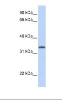 UCK2 Antibody - Jurkat cell lysate. Antibody concentration: 1.0 ug/ml. Gel concentration: 12%.  This image was taken for the unconjugated form of this product. Other forms have not been tested.